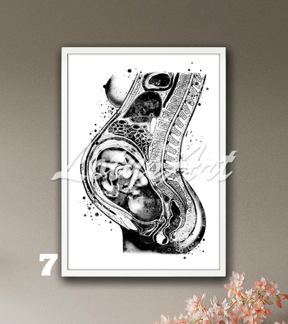 Fetus in womb watercolor poster in black and white, pregnancy anatomy medical decor & gynecology clinic gift